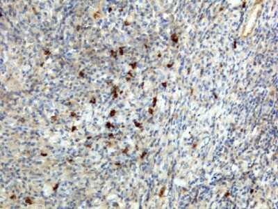 Immunohistochemistry: IgA Antibody (RM128) [Biotin] [NBP2-62023B] - Immunohistochemistry of human lymphoid tissue using unconjugated form of this antibody (NBP2-62023B)