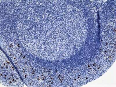 Immunohistochemistry: IgA2 Antibody (RM125) [Biotin] [NBP2-62025B] - Immunohistochemistry of human tonsil tissue using Anti-Human IgA2 antibody NBP2-62025B