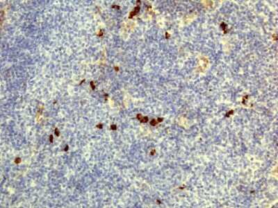 Immunohistochemistry: IgD Antibody (RM123) [Biotin] [NBP2-62026B] - Immunohistochemistry of human lymphoid tissue using Anti-Human IgD antibody NBP2-62026B.