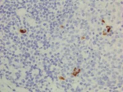 Immunohistochemistry: IgG3 Antibody (RM119) [Biotin] [NBP2-62125B] - Immunohistochemistry of human lymphoid tissue using Anti-Human IgG3 antibody NBP2-62125B.