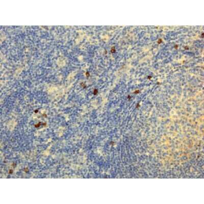 Immunohistochemistry: Rabbit anti-Human IgG4 Secondary Antibody (RM120) [Biotin] [NBP2-62126B] - Immunohistochemistry of Human Lymphoid Tissue using Anti-Human IgG4 antibody NBP2-62126B.