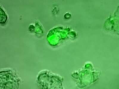 Immunocytochemistry/Immunofluorescence: Rabbit anti-Mouse IgG (H+L) Secondary Antibody [DyLight 488] (Pre-adsorbed) [NBP1-72889] - Hep core expression in Huh7 cells. Cells were fixed in 4% paraformaldehyde for 20 minutes at room temperature. The secondary antibody was diluted in 1% BSA in PBS at 1:500 dilution for 20 minutes at room temperature. Image from verified customer review.