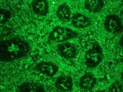 Immunohistochemistry: Rabbit anti-Mouse IgG1 Secondary Antibody (Azide Free) [NBP2-69526] - Immunocytochemistry/Immunofluorescence: Rabbit anti-Mouse, Porcine IgG1 Secondary Antibody [FITC] (Azide Free) [NBP2-69523] - used in a 1:200 dilution on swine colon, in combination with the primary monoclonal antibody to vimentin, RV202, used in a 1:1000 dilution. The green staining shows the connective tissue cells.