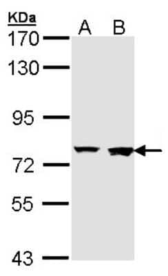 Western Blot: Rabenosyn 5 Antibody [NBP1-33649] - Sample (30 ug of whole cell lysate) A: H1299 B: Hela 7. 5% SDS PAGE; antibody diluted at 1:1000.