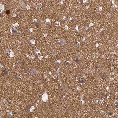 Immunohistochemistry-Paraffin: Rabphilin 3A Antibody [NBP1-87940] - Staining of human cerebral cortex shows strong positivity in neuropil.