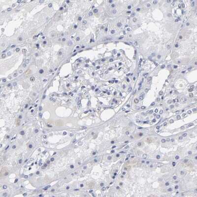 Immunohistochemistry-Paraffin: Rabphilin 3A Antibody [NBP1-87940] - Staining of human kidney shows no positivity in cells in tubules as expected.