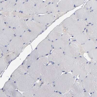 <b>Orthogonal Strategies Validation. </b>Immunohistochemistry-Paraffin: Rabphilin 3A Antibody [NBP1-87940] - Staining of human skeletal muscle shows no positivity in myocytes as expected.