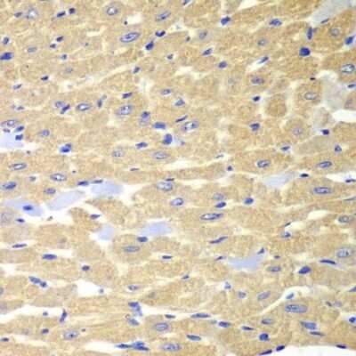 Immunohistochemistry-Paraffin: Rabphilin 3A Antibody [NBP2-95144] - Mouse heart using RPH3A antibody at dilution of 1:100 (40x lens).