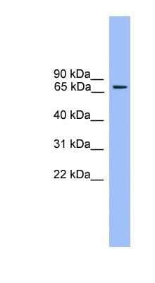 Western Blot: Rabphilin 3A Antibody [NBP1-69184] - Rph3a Antibody Titration: 0.2-1 ug/ml ELISA Titer: 1:1562500 Positive Control: Mouse Muscle