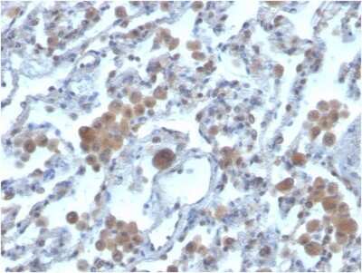 Immunohistochemistry-Paraffin: Rac1 Antibody (CPTC-RAC1-1) [NBP3-08939] - Formalin-fixed, paraffin-embedded human lung stained with Rac1 Mouse Monoclonal Antibody (CPTC-Rac1-1).