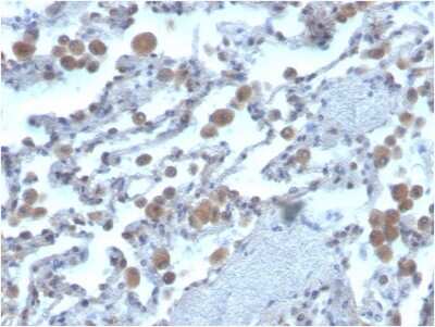 Immunohistochemistry-Paraffin: Rac1 Antibody (CPTC-RAC1-1) [NBP3-08939] - Formalin-fixed, paraffin-embedded human lung stained with Rac1 Mouse Monoclonal Antibody (CPTC-Rac1-1).