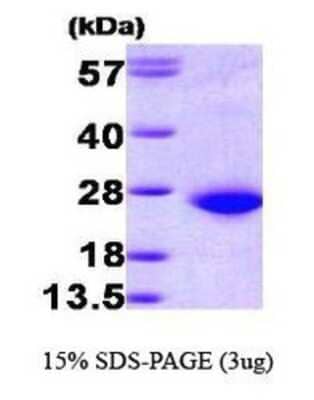 SDS-Page: Recombinant Human Rac1 Protein [NBP1-30261] - RAC1, 23.6 kDa (212aa), confirmed by MALDI-TOF with a purity of 95% by SDS - PAGE