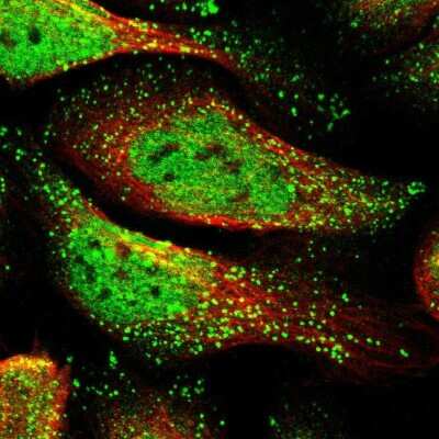 Immunocytochemistry/Immunofluorescence: Rad1 Antibody [NBP2-13196] - Staining of human cell line U-2 OS shows localization to nucleoplasm & vesicles. Antibody staining is shown in green.