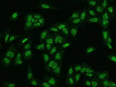 Immunocytochemistry/Immunofluorescence: Rad1 Antibody [NBP2-97717] - Immunofluorescence staining of Rad1 in U2OS cells. Cells were fixed with 4% PFA, permeabilzed with 0.1% Triton X-100 in PBS, blocked with 10% serum, and incubated with rabbit anti-Human Rad1 polyclonal antibody (dilution ratio 1:200) at 4C overnight. Then cells were stained with the Alexa Fluor(R)488-conjugated Goat Anti-rabbit IgG secondary antibody (green). Positive staining was localized to Nucleus.