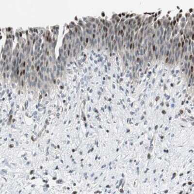 Immunohistochemistry-Paraffin: Rad1 Antibody [NBP2-13196] - Staining of human urinary bladder shows moderate nuclear positivity in urothelial cells.