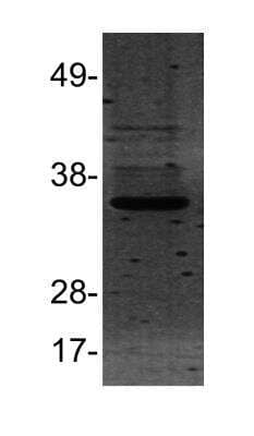 Western Blot: Rad1 Antibody [NB100-56320] - Analysis of Rad1 in HEK293 cell lysate using anti-Rad1 antibody. Image from verified customer review.