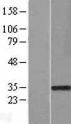 Western Blot Rad1 Overexpression Lysate