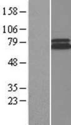 Western Blot Rad1 Overexpression Lysate