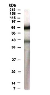 Western Blot: Rad17 Antibody [NB100-173] - WB detection of RAD17 protein in human heart lysate using NB100-173 at a dilution of 1:500