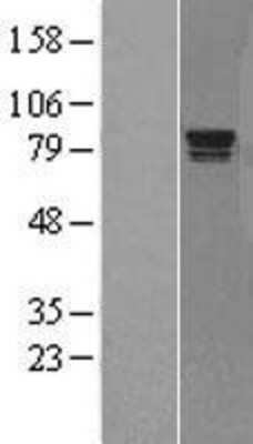 Western Blot Rad17 Overexpression Lysate