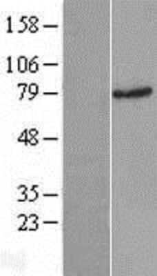 Western Blot: Rad17 Overexpression Lysate (Adult Normal) [NBP2-05720] Left-Empty vector transfected control cell lysate (HEK293 cell lysate); Right -Over-expression Lysate for Rad17.