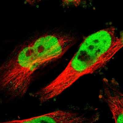 Immunocytochemistry/Immunofluorescence: Rad21 Antibody [NBP1-83260] - Immunofluorescent staining of human cell line U-251 MG shows localization to nucleoplasm.