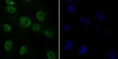 Immunocytochemistry/Immunofluorescence: Rad21 Antibody [NBP2-76959] - ICC staining Rad21 in MG-63 cells (green). Formalin fixed cells were permeabilized with 0.1% Triton X-100 in TBS for 10 minutes at room temperature and blocked with 1% Blocker BSA for 15 minutes at room temperature. Cells were probed with Rad21 polyclonal antibody at a dilution of 1:100 for 1 hour at room temperature, washed with PBS. Alexa Fluorc 488 Goat anti-Rabbit IgG was used as the secondary antibody at 1/100 dilution. The nuclear counter stain is DAPI (blue).