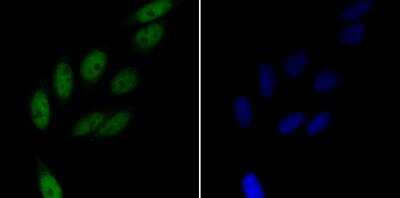 Immunocytochemistry/Immunofluorescence: Rad21 Antibody [NBP2-76959] - ICC staining Rad21 in SiHa cells (green). Formalin fixed cells were permeabilized with 0.1% Triton X-100 in TBS for 10 minutes at room temperature and blocked with 1% Blocker BSA for 15 minutes at room temperature. Cells were probed with Rad21 polyclonal antibody at a dilution of 1:100 for 1 hour at room temperature, washed with PBS. Alexa Fluorc 488 Goat anti-Rabbit IgG was used as the secondary antibody at 1/100 dilution. The nuclear counter stain is DAPI (blue).