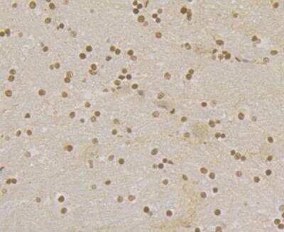 Immunohistochemistry: Rad21 Antibody [NBP2-76959] - Immunohistochemical analysis of paraffin-embedded rat brain tissue using anti-Rad21 antibody. The section was pre-treated using heat mediated antigen retrieval with sodium citrate buffer (pH 6.0) for 20 minutes. The tissues were blocked in 5% BSA for 30 minutes at room temperature, washed with ddH2O and PBS, and then probed with the antibody at 1/200 dilution, for 30 minutes at room temperature and detected using an HRP conjugated compact polymer system. DAB was used as the chrogen. Counter stained with hematoxylin and mounted with DPX.