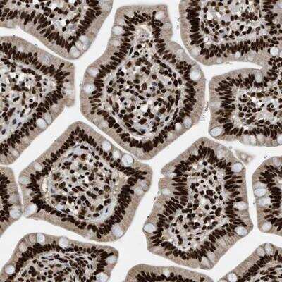 Immunohistochemistry-Paraffin: Rad21 Antibody [NBP1-83260] - Staining of human small intestine shows strong nuclear positivity in glandular cells.