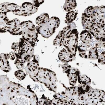 Immunohistochemistry-Paraffin: Rad21 Antibody [NBP1-83260] - Staining of human placenta shows strong nuclear positivity in trophoblastic cells.