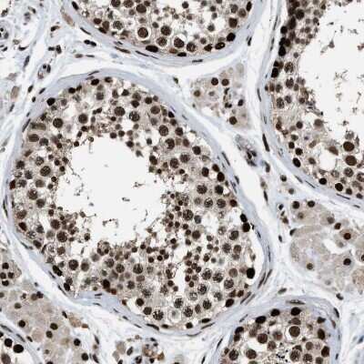 Immunohistochemistry-Paraffin: Rad21 Antibody [NBP1-83260] - Staining of human testis shows strong nuclear positivity in cells in seminiferous ducts.