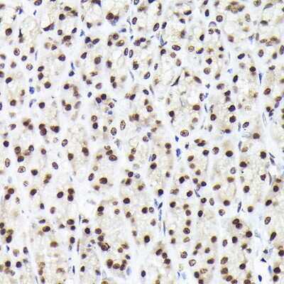 Immunohistochemistry-Paraffin: Rad21 Antibody [NBP3-15608] - Immunohistochemistry of paraffin-embedded rat stomach using Rad21 Rabbit pAb (NBP3-15608) at dilution of 1:200 (40x lens).Perform high pressure antigen retrieval with 10 mM citrate buffer pH 6.0 before commencing with IHC staining protocol.