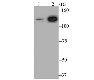 Western Blot: Rad21 Antibody [NBP2-76959] - Western blot analysis of Rad21 on different lysates. Proteins were transferred to a PVDF membrane and blocked with 5% BSA in PBS for 1 hour at room temperature. The primary antibody was used at a 1:500 dilution in 5% BSA at room temperature for 2 hours. Goat Anti-Rabbit IgG - HRP Secondary Antibody at 1:5,000 dilution was used for 1 hour at room temperature.Positive control: Lane 1: Mouse ovary tissue lysate Lane 2: Daudi cell lysate