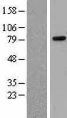 Western Blot: Rad21 Overexpression Lysate (Adult Normal) [NBL1-15114] Left-Empty vector transfected control cell lysate (HEK293 cell lysate); Right -Over-expression Lysate for Rad21.