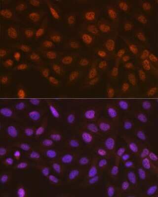 Immunocytochemistry/Immunofluorescence: Rad23 Antibody (3B7T9) [NBP3-16573] - Immunofluorescence analysis of U-2 OS cells using Rad23 Rabbit mAb (NBP3-16573) at dilution of 1:100 (40x lens). Blue: DAPI for nuclear staining.