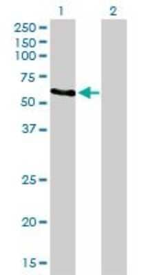 Western Blot: Rad23 Antibody (3C12) [H00005886-M01] - Analysis of RAD23A expression in transfected 293T cell line by RAD23A monoclonal antibody (M01), clone 3C12. Lane 1: RAD23A transfected lysate (39.6 KDa). Lane 2: Non-transfected lysate.