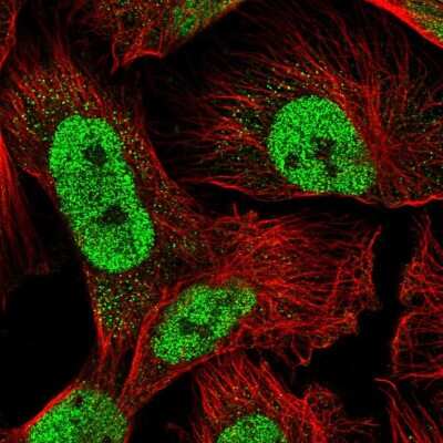 Immunocytochemistry/Immunofluorescence: Rad23 Antibody [NBP2-55089] - Staining of human cell line U-251 MG shows localization to nucleoplasm & cytosol.