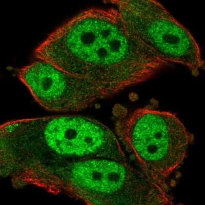 Immunocytochemistry/Immunofluorescence: Rad23 Antibody [NBP2-56143] - Staining of human cell line PC-3 shows localization to nucleoplasm & cytosol.