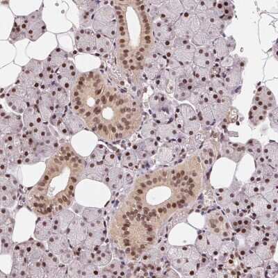 Immunohistochemistry: Rad23 Antibody [NBP2-38072] - Staining of human salivary gland shows strong nuclear positivity in glandular cells.
