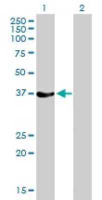 Western Blot: Rad51 Antibody (2E5-E5) [H00005888-M01] - Analysis of RAD51 expression in transfected 293T cell line by RAD51 monoclonal antibody (M01), clone 2E5-E5.Lane 1: RAD51 transfected lysate(37 KDa).Lane 2: Non-transfected lysate.
