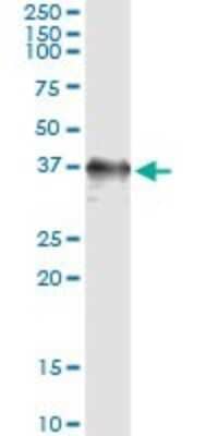 Immunoprecipitation: Rad51 Antibody (4C11-B4) [H00005888-M02] - Analysis of RAD51 transfected lysate using anti-RAD51 monoclonal antibody and Protein A Magnetic Bead, and immunoblotted with RAD51 MaxPab rabbit polyclonal antibody.