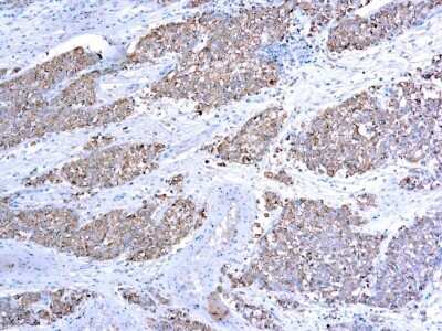 Immunohistochemistry-Paraffin: Rad51 Antibody (51RAD01) [NBP2-26426] - Formalin fixed paraffin embedded human testis stained with Rad51 antibody (NBP2-26426).