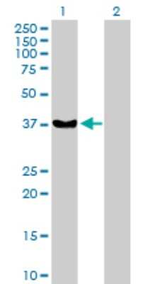 Western Blot: Rad51 Antibody [H00005888-D01P] - Analysis of RAD51 expression in transfected 293T cell line by RAD51 polyclonal antibody.Lane 1: RAD51 transfected lysate(37.00 KDa).Lane 2: Non-transfected lysate.