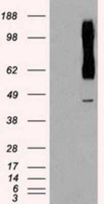 Western Blot: Rad9 Antibody (OTI7B11) - Azide and BSA Free [NBP2-73783] - HEK293T cells were transfected with the pCMV6-ENTRY control (Left lane) or pCMV6-ENTRY Rad9 (Right lane) cDNA for 48 hrs and lysed. Equivalent amounts of cell lysates (5 ug per lane) were separated by SDS-PAGE and immunoblotted with anti-Rad9.