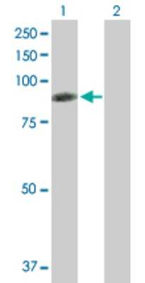 Western Blot: Radixin Antibody [H00005962-B01P] - Analysis of RDX expression in transfected 293T cell line by RDX polyclonal antibody.  Lane 1: RDX transfected lysate(64.13 KDa). Lane 2: Non-transfected lysate.