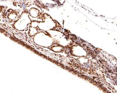 Immunohistochemistry-Paraffin: Raf-1 [p Ser621] Antibody (JJ085-05) [NBP2-67855] - Analysis of paraffin-embedded rat trachea tissue using anti-Raf-1 [p Ser621] antibody. The section was pre-treated using heat mediated antigen retrieval with sodium citrate buffer (pH 6.0) for 20 minutes. The tissues were blocked in 1% BSA for 30 minutes at room temperature, washed with ddH2O and PBS, and then probed with the primary antibody (1/400) for 30 minutes at room temperature. The detection was performed using an HRP conjugated compact polymer system. DAB was used as the chromogen. Tissues were counterstained with hematoxylin and mounted with DPX.