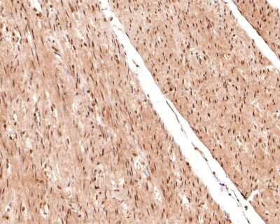 Immunohistochemistry-Paraffin: Raf-1 [p Ser621] Antibody (JJ085-05) [NBP2-67855] - Analysis of paraffin-embedded human muscle tissue using anti-Raf-1 [p Ser621] antibody. The section was pre-treated using heat mediated antigen retrieval with sodium citrate buffer (pH 6.0) for 20 minutes. The tissues were blocked in 1% BSA for 30 minutes at room temperature, washed with ddH2O and PBS, and then probed with the primary antibody (1/400) for 30 minutes at room temperature. The detection was performed using an HRP conjugated compact polymer system. DAB was used as the chromogen. Tissues were counterstained with hematoxylin and mounted with DPX.