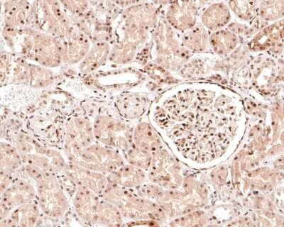 Immunohistochemistry-Paraffin: Raf-1 [p Ser621] Antibody (JJ085-05) [NBP2-67855] - Analysis of paraffin-embedded human kidney tissue using anti-Raf-1 [p Ser621] antibody. The section was pre-treated using heat mediated antigen retrieval with sodium citrate buffer (pH 6.0) for 20 minutes. The tissues were blocked in 1% BSA for 30 minutes at room temperature, washed with ddH2O and PBS, and then probed with the primary antibody (1/100) for 30 minutes at room temperature. The detection was performed using an HRP conjugated compact polymer system. DAB was used as the chromogen. Tissues were counterstained with hematoxylin and mounted with DPX.