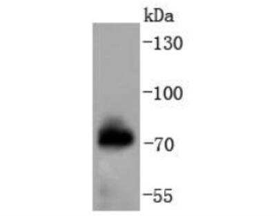 Western Blot: Raf-1 [p Ser621] Antibody (JJ085-05) [NBP2-67855] - Analysis of Phospho-Raf1(S621) on human skeletal muscle lysates using anti-Phospho-Raf1(S621) antibody.